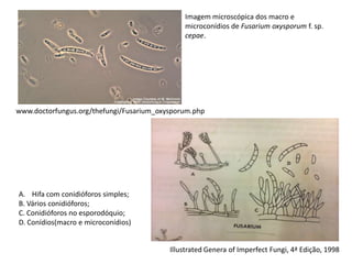 www.doctorfungus.org/thefungi/Fusarium_oxysporum.php
Illustrated Genera of Imperfect Fungi, 4ª Edição, 1998
A. Hifa com conidióforos simples;
B. Vários conidióforos;
C. Conidióforos no esporodóquio;
D. Conídios(macro e microconídios)
Imagem microscópica dos macro e
microconídios de Fusarium oxysporum f. sp.
cepae.
 