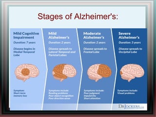 Stages of Alzheimer's:
 
