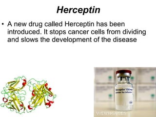 Herceptin A new drug called Herceptin has been introduced. It stops cancer cells from dividing and slows the development of the disease 