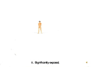 ii.  Significantly exposed,  