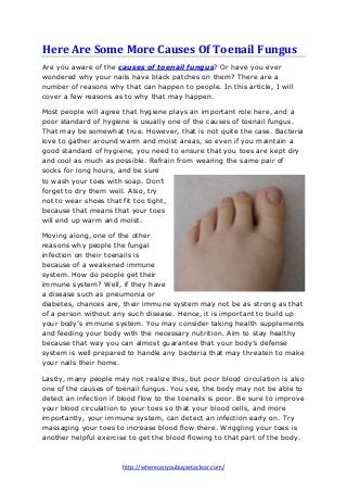 Here Are Some More Causes Of Toenail Fungus
Are you aware of the causes of toenail fungus? Or have you ever
wondered why your nails have black patches on them? There are a
number of reasons why that can happen to people. In this article, I will
cover a few reasons as to why that may happen.
Most people will agree that hygiene plays an important role here, and a
poor standard of hygiene is usually one of the causes of toenail fungus.
That may be somewhat true. However, that is not quite the case. Bacteria
love to gather around warm and moist areas, so even if you maintain a
good standard of hygiene, you need to ensure that you toes are kept dry
and cool as much as possible. Refrain from wearing the same pair of
socks for long hours, and be sure
to wash your toes with soap. Don’t
forget to dry them well. Also, try
not to wear shoes that fit too tight,
because that means that your toes
will end up warm and moist.
Moving along, one of the other
reasons why people the fungal
infection on their toenails is
because of a weakened immune
system. How do people get their
immune system? Well, if they have
a disease such as pneumonia or
diabetes, chances are, their immune system may not be as strong as that
of a person without any such disease. Hence, it is important to build up
your body’s immune system. You may consider taking health supplements
and feeding your body with the necessary nutrition. Aim to stay healthy
because that way you can almost guarantee that your body’s defense
system is well prepared to handle any bacteria that may threaten to make
your nails their home.
Lastly, many people may not realize this, but poor blood circulation is also
one of the causes of toenail fungus. You see, the body may not be able to
detect an infection if blood flow to the toenails is poor. Be sure to improve
your blood circulation to your toes so that your blood cells, and more
importantly, your immune system, can detect an infection early on. Try
massaging your toes to increase blood flow there. Wriggling your toes is
another helpful exercise to get the blood flowing to that part of the body.

http://wherecanyoubuyzetaclear.com/

 