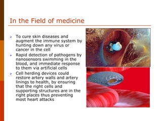 In the Field of medicine
 To cure skin diseases and
augment the immune system by
hunting down any virus or
cancer in the cell
 Rapid detection of pathogens by
nanosensors swimming in the
blood, and immediate response
to them via artificial cells
 Cell herding devices could
restore artery walls and artery
linings to health, by ensuring
that the right cells and
supporting structures are in the
right places thus preventing
most heart attacks
 