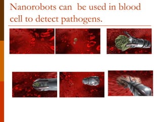 Nanorobots can be used in blood
cell to detect pathogens.
 