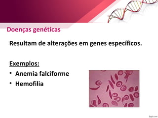 Doenças genéticas 
Resultam de alterações em genes específicos. 
Exemplos: 
• Anemia falciforme 
• Hemofilia 
 