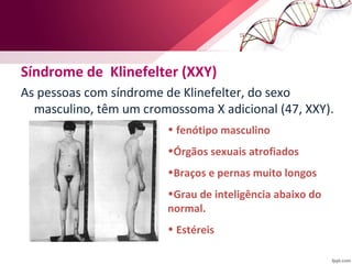 Síndrome de Klinefelter (XXY) 
As pessoas com síndrome de Klinefelter, do sexo 
masculino, têm um cromossoma X adicional (47, XXY). 
• fenótipo masculino 
•Órgãos sexuais atrofiados 
•Braços e pernas muito longos 
•Grau de inteligência abaixo do 
normal. 
• Estéreis 
