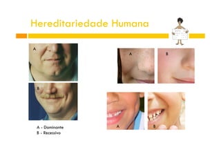 Hereditariedade Humana
A

A

B

B

A - Dominante
B - Recessivo

A

B

 