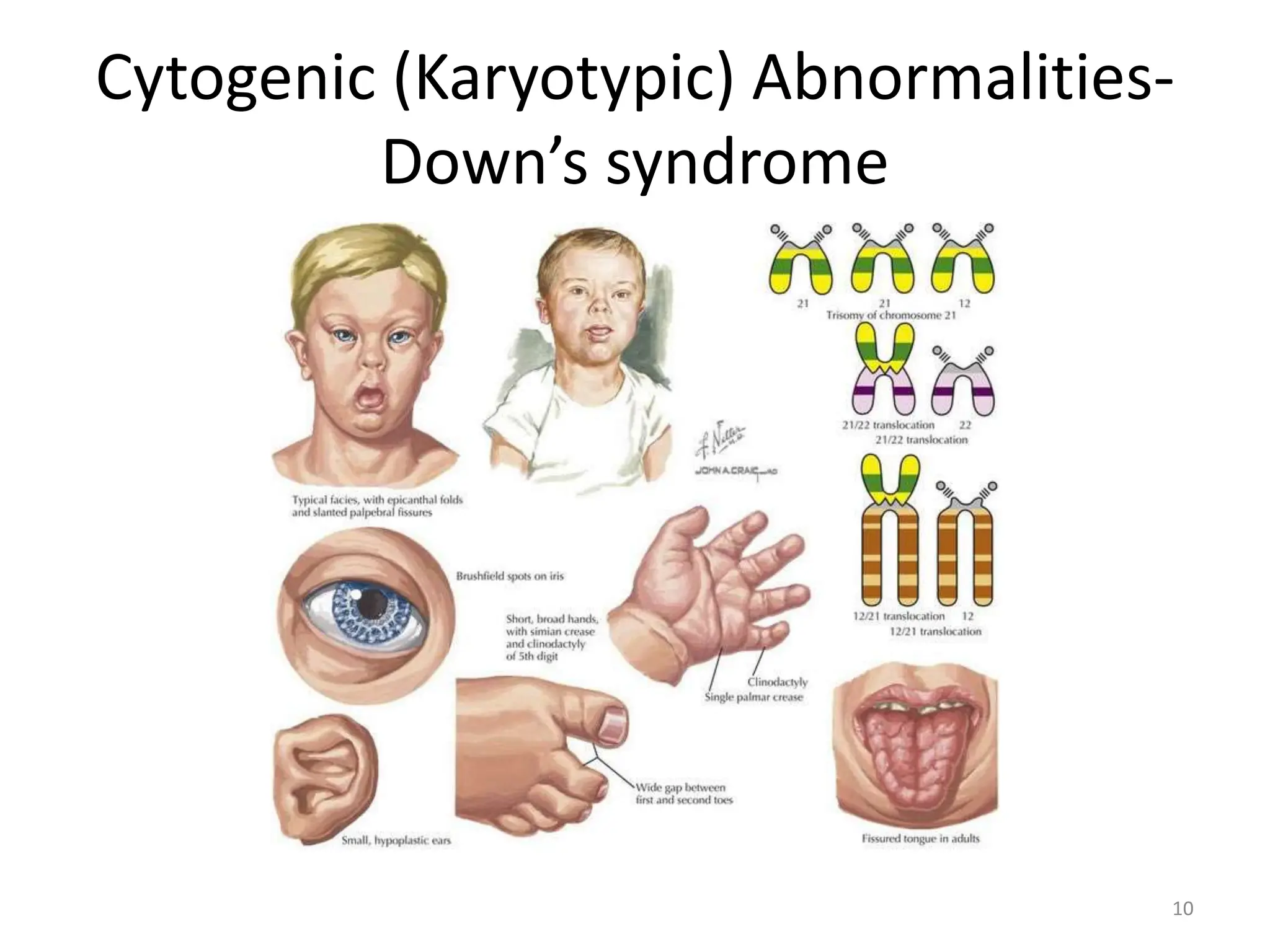 Hereditary diseases-SGB -.pptx