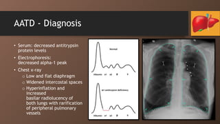Rarification Hereditary Liver Diseases- .pptx