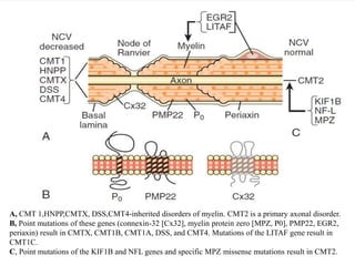 A, CMT 1,HNPP,CMTX, DSS,CMT4-inherited disorders of myelin. CMT2 is a primary axonal disorder.
B, Point mutations of these genes (connexin-32 [Cx32], myelin protein zero [MPZ, P0], PMP22, EGR2,
periaxin) result in CMTX, CMT1B, CMT1A, DSS, and CMT4. Mutations of the LITAF gene result in
CMT1C.
C, Point mutations of the KIF1B and NFL genes and specific MPZ missense mutations result in CMT2.
 