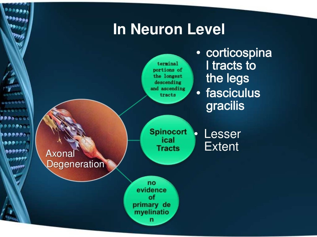hereditary-spastic-paraplegia