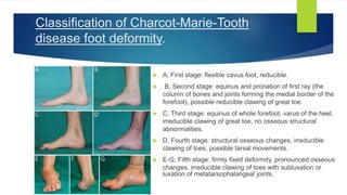 Hereditory peripheral neuropathy | PPTX