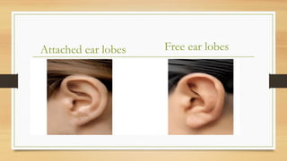 Free ear lobes
Attached ear lobes
 