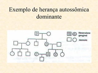 Exemplo de herança autossômica
dominante
 