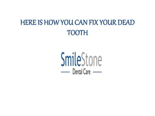 HERE IS HOW YOU CAN FIX YOUR DEAD
TOOTH
 