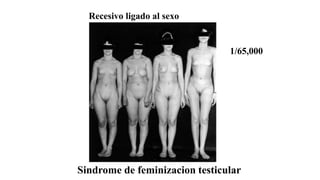 Sindrome de feminizacion testicular
1/65,000
Recesivo ligado al sexo
 