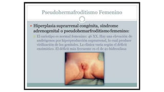 Herencia_Ligada_al_Sexo.pptx