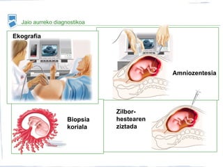 Jaio aurreko diagnostikoa
Amniozentesia
Ekografia
Biopsia
koriala
Zilbor-
hestearen
ziztada
 