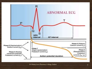 B K Mody Govt Pharmacy College, Rajkot 7
ABNORMAL ECG
 