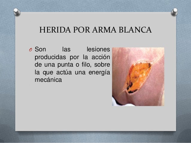 Herida por arma blanca 1