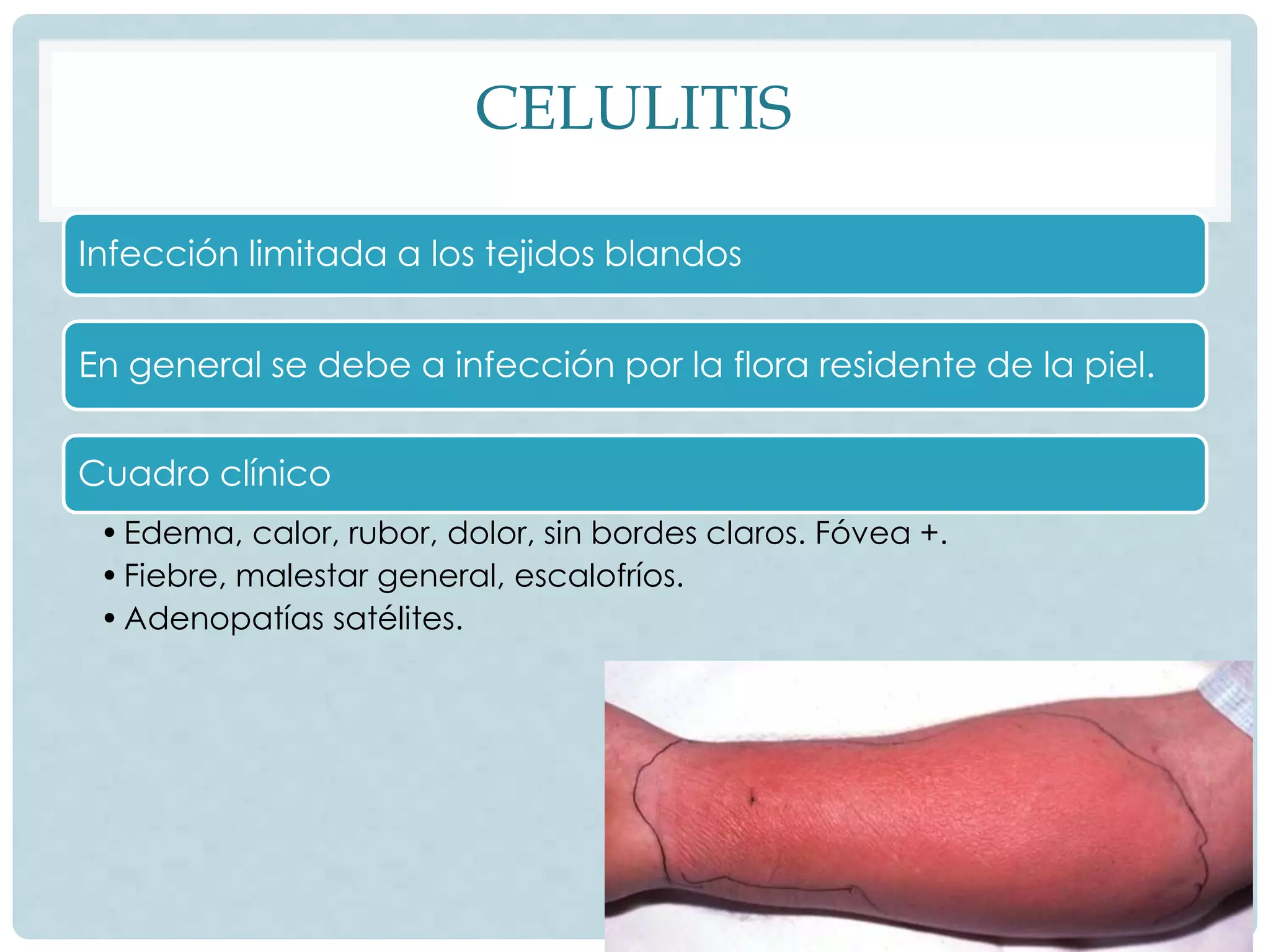 Herida quirrgica e infectada | PPTX