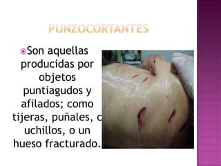 PUNZOCORTANTESSon aquellas producidas por objetos puntiagudos y afilados; como tijeras, puñales, cuchillos, o un hueso fracturado. 