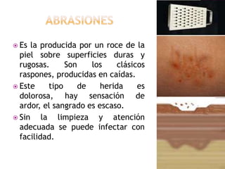 AbrasionesEs la producida por un roce de la piel sobre superficies duras y rugosas. Son los clásicos raspones, producidas en caídas. Este tipo de herida es dolorosa, hay sensación de ardor, el sangrado es escaso.Sin la limpieza y atención adecuada se puede infectar con facilidad.