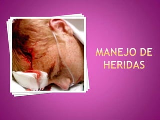 Manejo de heridas