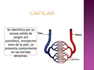 VENOSASe identifica por su color rojo oscuro y su salida es continua. (Sale en forma de escurrimiento) 