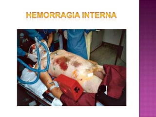 Sin embargo una adecuada evaluación del lugar y de la condición del paciente nos podrán indicar que la persona lesionada se encuentra en una situación de absoluta gravedad por lo que es de alta prioridad su traslado.