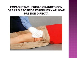 Aplicar presión directa con la puntas de los dedos enguantados al sitio de sangrado, si este no se detiene