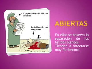 ABIERTASEn ellas se observa la separación de los tejidos blandos.Tienden a infectarse muy fácilmente