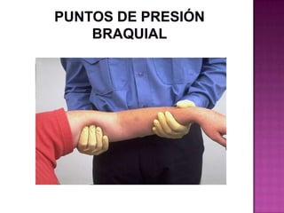 Puntos de Presión