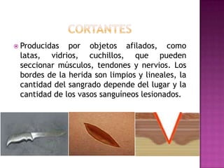 CortantesProducidas por objetos afilados, como latas, vidrios, cuchillos, que pueden seccionar músculos, tendones y nervios. Los bordes de la herida son limpios y lineales, la cantidad del sangrado depende del lugar y la cantidad de los vasos sanguíneos lesionados.