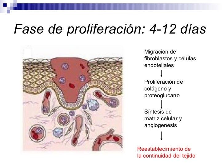 Heridas