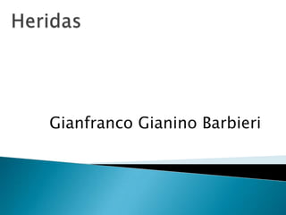 Gianfranco Gianino Barbieri
 
