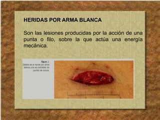 HERIDAS POR ARMA BLANCA
Son las lesiones producidas por la acción de una
punta o filo, sobre la que actúa una energía
mecánica.
 