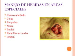 MANEJO DE HERIDAS EN AREAS
ESPECIALES
 Cuero cabelludo.
 Cejas
 Parpados
 Nariz
 Labios
 Pabellón auricular
 lengua
 