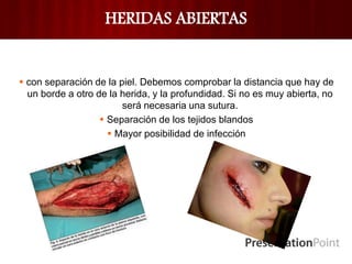 HERIDAS ABIERTAS
 con separación de la piel. Debemos comprobar la distancia que hay de
un borde a otro de la herida, y la profundidad. Si no es muy abierta, no
será necesaria una sutura.
 Separación de los tejidos blandos
 Mayor posibilidad de infección
 