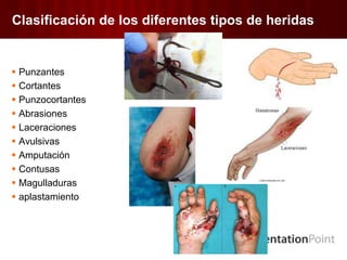 Clasificación de los diferentes tipos de heridas
 Punzantes
 Cortantes
 Punzocortantes
 Abrasiones
 Laceraciones
 Avulsivas
 Amputación
 Contusas
 Magulladuras
 aplastamiento
 
