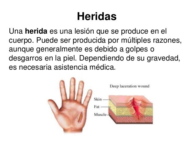 Que curar las uñas después del levantamiento el gel del barniz