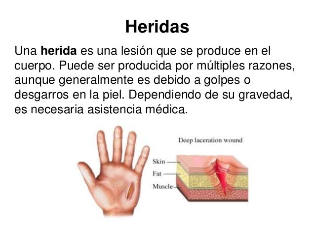 Resultado de imagen para heridas