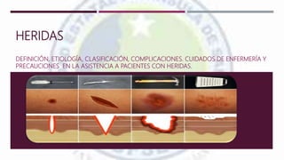 HERIDAS
DEFINICIÓN, ETIOLOGÍA, CLASIFICACIÓN, COMPLICACIONES. CUIDADOS DE ENFERMERÍA Y
PRECAUCIONES EN LA ASISTENCIA A PACIENTES CON HERIDAS.
Castro Lema
García Axel
González Coral
González Ramírez
Suárez Pozo
Torres Mantuano
 