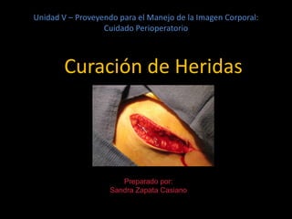 Unidad V – Proveyendo para el Manejo de la Imagen Corporal:
Cuidado Perioperatorio
Curación de Heridas
Preparado por:
Sandra Zapata Casiano
 