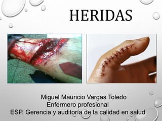 HERIDAS
Miguel Mauricio Vargas Toledo
Enfermero profesional
ESP. Gerencia y auditoría de la calidad en salud
 