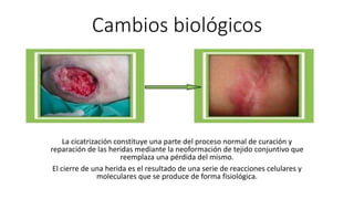 Cambios biológicos
La cicatrización constituye una parte del proceso normal de curación y
reparación de las heridas mediante la neoformación de tejido conjuntivo que
reemplaza una pérdida del mismo.
El cierre de una herida es el resultado de una serie de reacciones celulares y
moleculares que se produce de forma fisiológica.
 