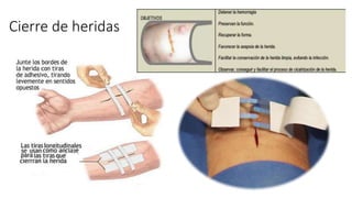 Cierre de heridas
 