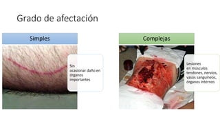 Grado de afectación
Sin
ocasionar daño en
órganos
importantes
Simples
Lesiones
en músculos
tendones, nervios,
vasos sanguíneos,
órganos internos
Complejas
 