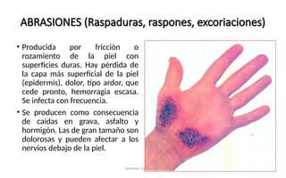Como Curar Raspones HERIDAS- CONCEPTO- CUADRO CLINICO - CURACION DE HERIDASppt | PPT