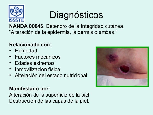 Diagnostico Deterioro De La Integridad Cutanea es.slideshare.net