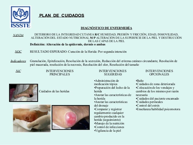 Heridas metodo enfermero